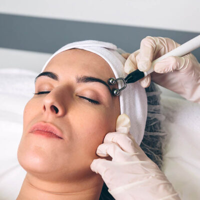 RF Facial Treatment