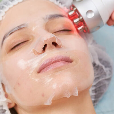 RF Facial Treatment Stockton