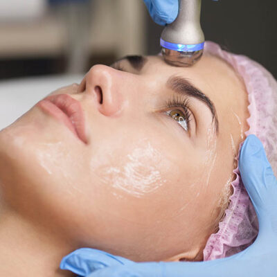 RF Facial Treatment